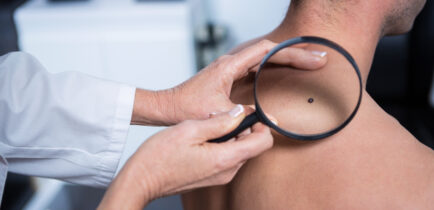 Aktualności - Bezpłatne badania znamion skóry w dermobusie